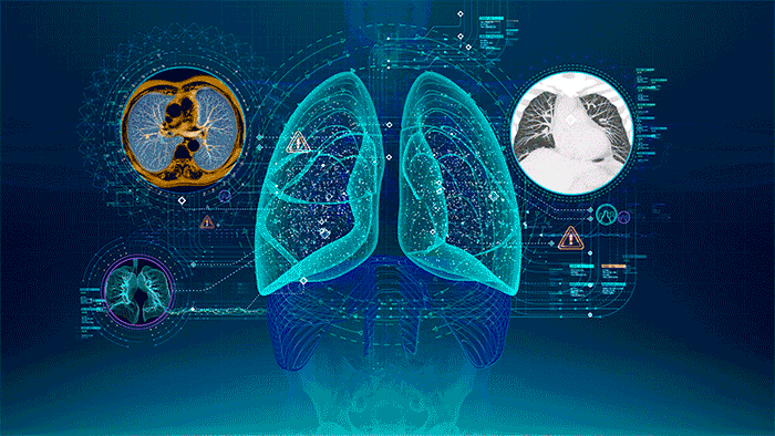 The Rise Of Artificial Intelligence: How It's Changing The World